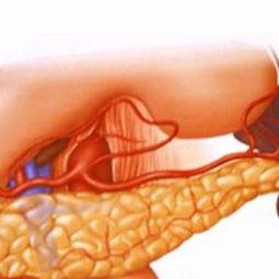水瓜胰腺癌可以吃吗吗